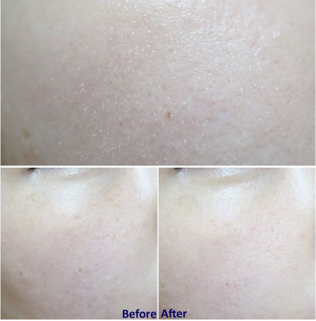 Xịt Khoáng Bio-essence Bio-Water Cho Da Nhạy Cảm 30ml