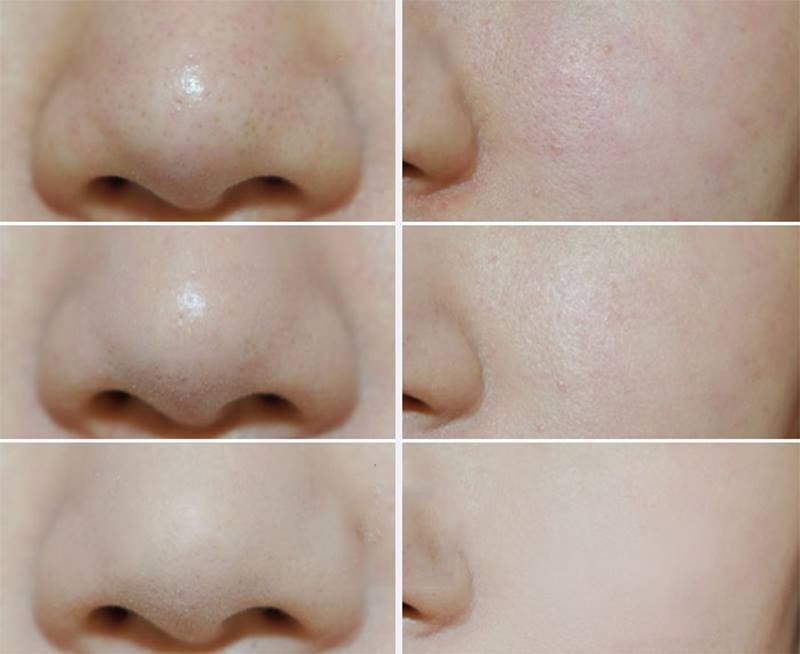 Phấn Phủ Shiseido Baby Powder Pressed 50gr
