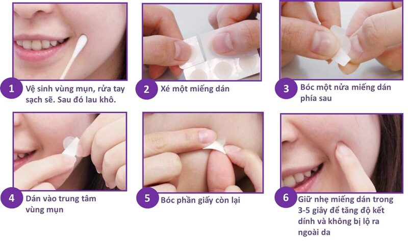Miếng Dán Mụn Mayan Ultra Thin Spot Acne Patch 20+4 PCS