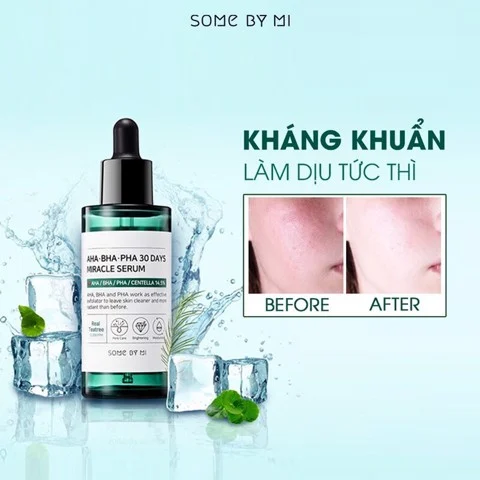 Tinh Chất Some By Mi AHA-BHA-PHA 30 Days Miracle Serum Cho Da Mụn 50ml