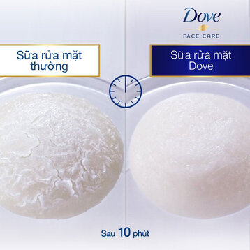 Sữa Rửa Mặt Dove Cấp Ẩm, Làm Mềm Da 30g