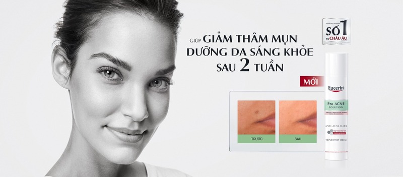 Bộ Sản Phẩm Eucerin Serum & Toner Giúp Giảm Thâm Mụn 