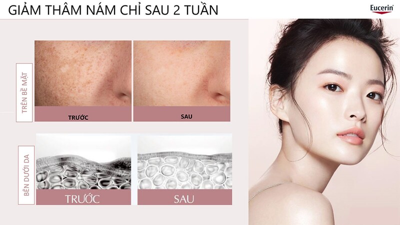 Bộ Sản Phẩm Eucerin Serum & Nước Dưỡng Giảm Thâm Nám, Kiểm Soát Dầu