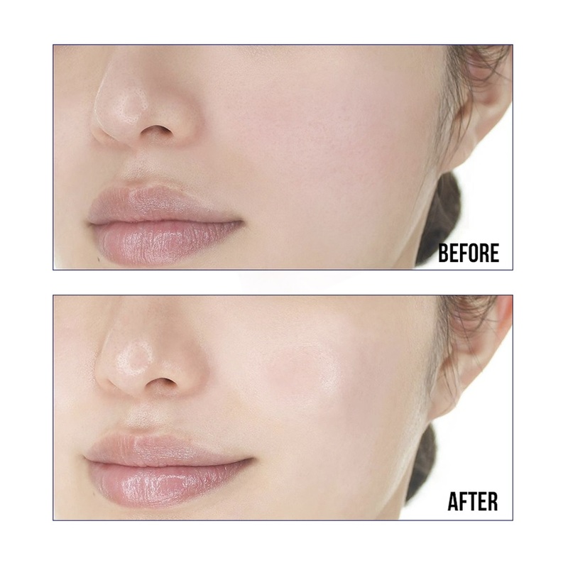 Serum Sur.Medic+ Super Peptide 100™ Collagen Lifting Phục Hồi Tái Tạo Da Hư Tổn 50ml