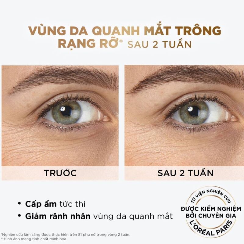Serum Loreal Revitalift Hyaluronic Acid Giảm Bọng Mắt & Làm Đầy Rãnh Nhăn 20ml