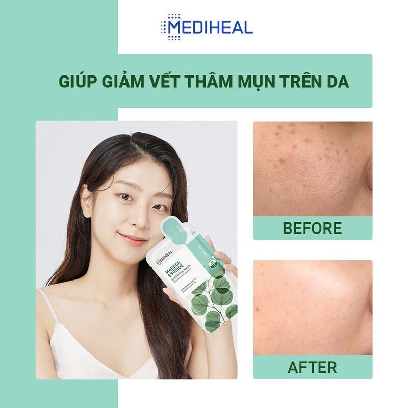 Mặt Nạ Mediheal Madecassoside Essential Mask Chiết Xuất Rau Má Cho Da Nhạy Cảm 24ml
