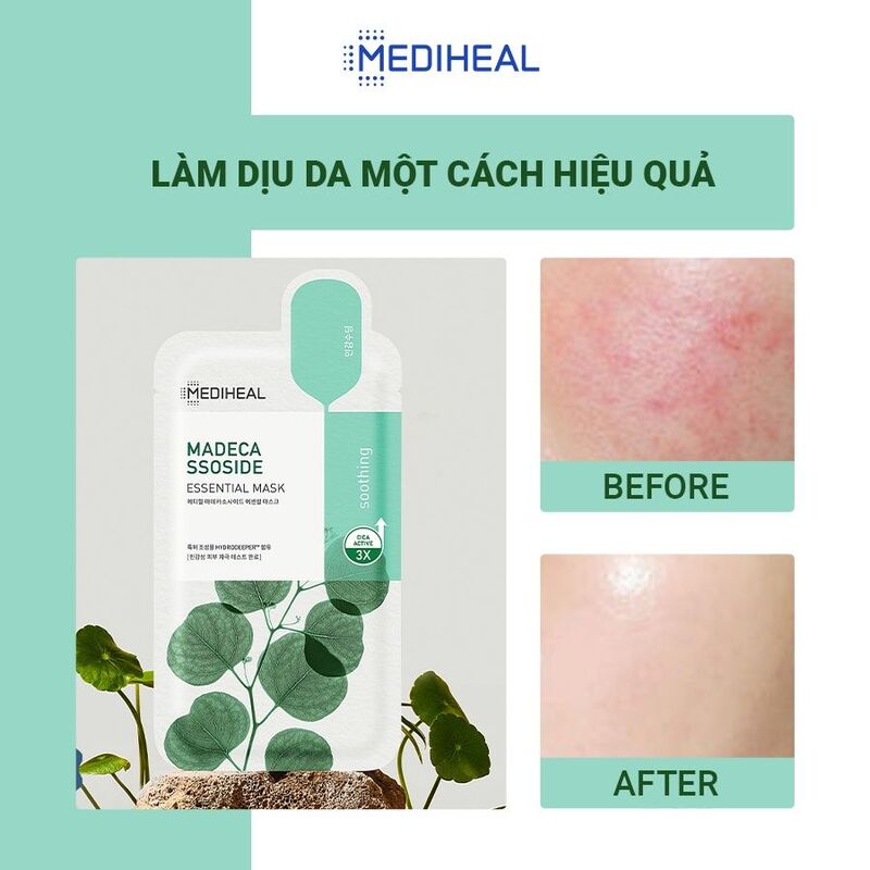 Mặt Nạ Mediheal Madecassoside Essential Mask Chiết Xuất Rau Má Cho Da Nhạy Cảm 24ml