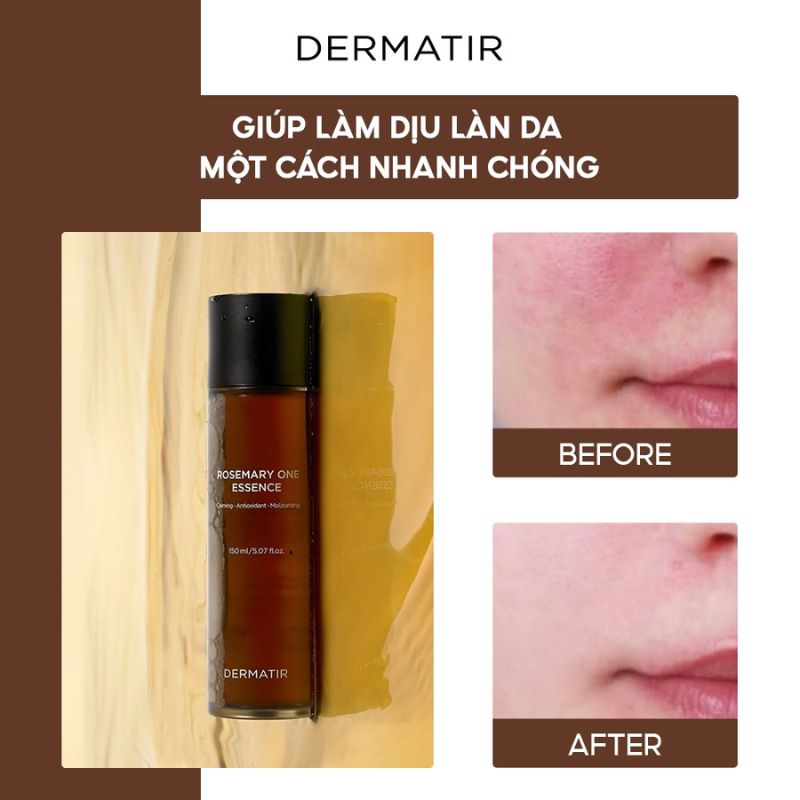 Tinh Chất DERMATIR Hương Thảo ROSEMARY ONE ESSENCE 150ml
