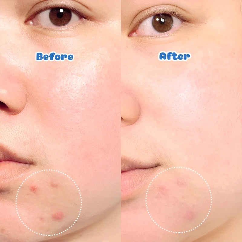 Bộ Sản Phẩm La Roche-Posay Tẩy Trang Effaclar 400ml + Sữa Rửa Mặt Effaclar 50ml Làm Sạch Sâu Cho Da Dầu Mụn