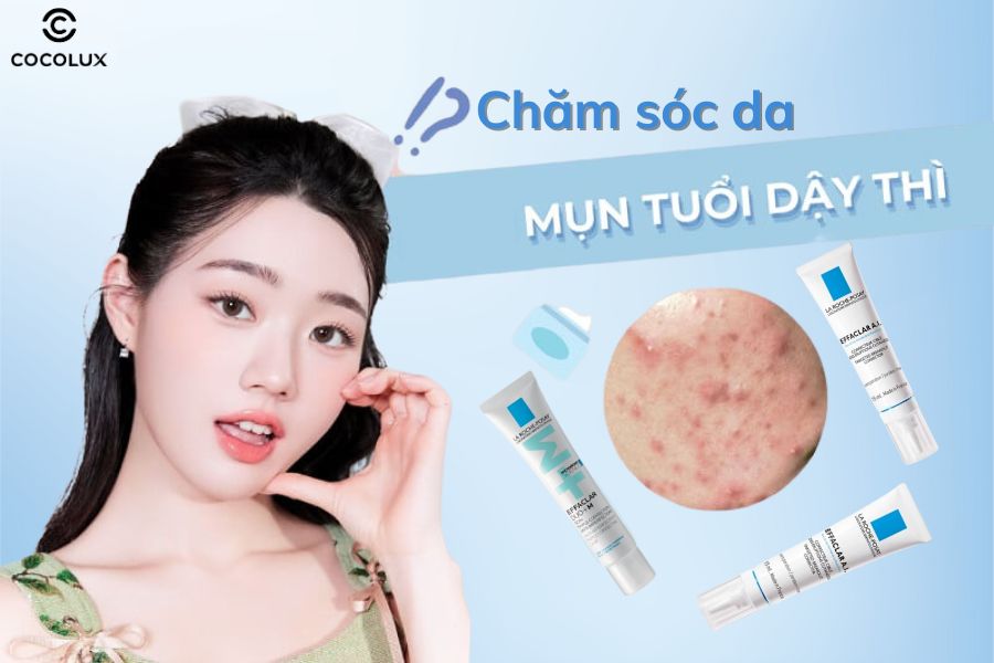 Chăm sóc da mụn trứng cá tuổi dậy thì với kem dưỡng La Roche-Posay