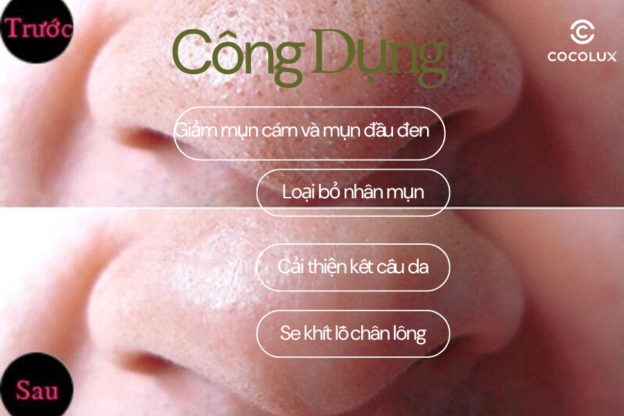 Công dụng của miếng dán lột mụn Biore