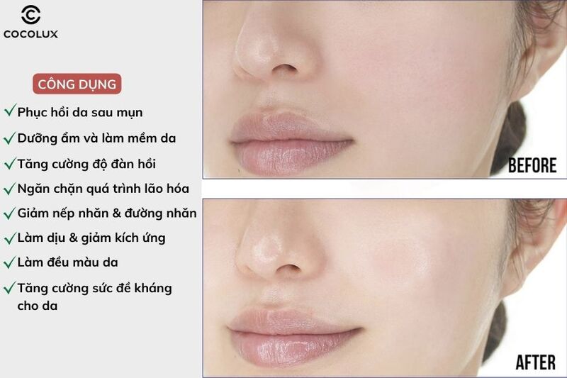 Review Serum Sur.Medic+ Super Peptide 100™ Collagen Lifting