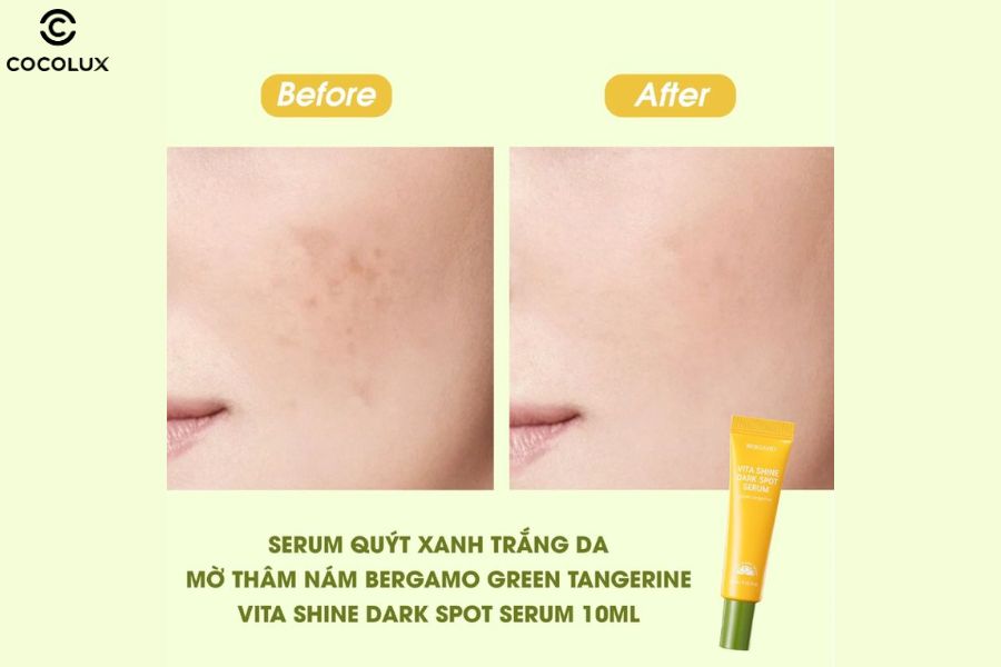 Công dụng mờ thâm nám của tinh chất Bergamo quýt xanh trắng da mờ thâm nám