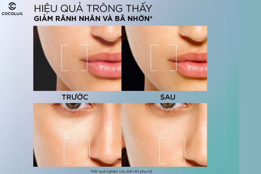 C&ocirc;ng dụng của kem dưỡng da L'or&eacute;al Paris Revitalift Hyaluronic Acid 8H Oil Control Gel-Cream