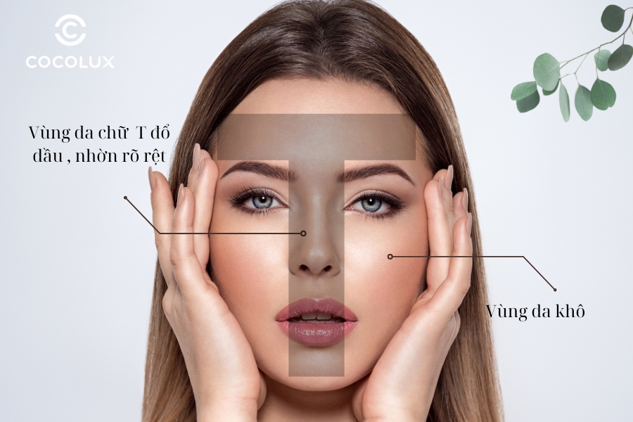 Đặc điểm của da hỗn hợp thiên dầu