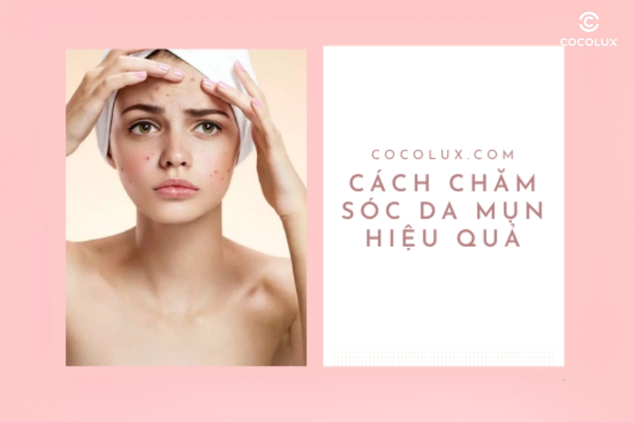 Da mụn đừng vội lo lắng "Cách chăm sóc da mụn hiệu quả"