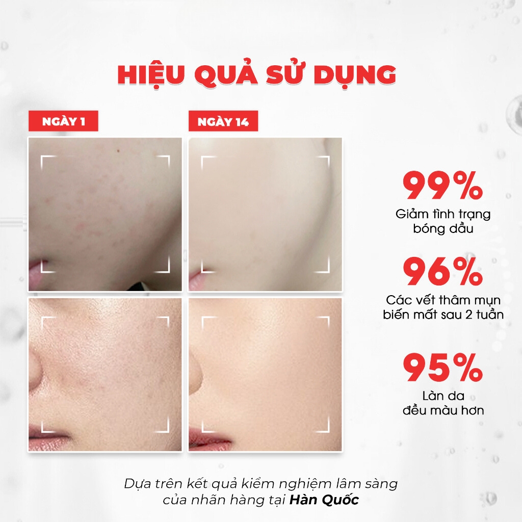 Tinh Chất Angel's Liquid Glutathione + Niacinamide Cica Ampoule 7 Days Whitening Program - Limited Edition