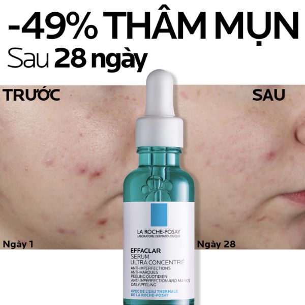 Serum La Roche-Posay Effaclar Giảm Mụn 30ml