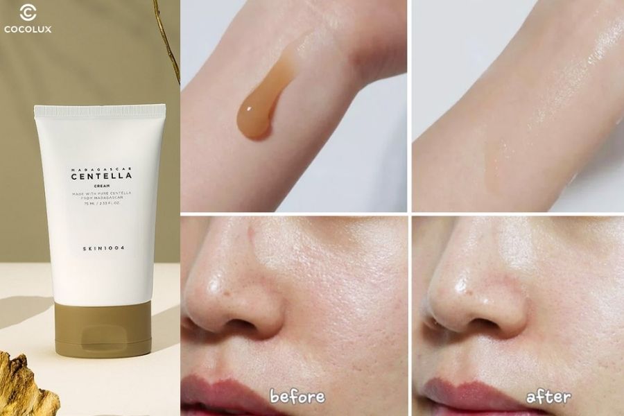 C&ocirc;ng dụng của kem dưỡng Skin1004 Madagascar Centella Soothing Cream