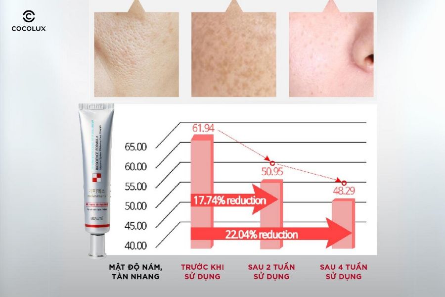 hiệu quả khi sử dụng Kem dưỡng Melasma-X 3D Whitening Clinic Renewal