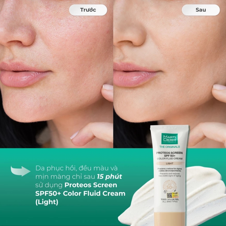 Kem Chống Nắng MartiDerm The Originals Proteos Screen SPF50+ 40ml - Light