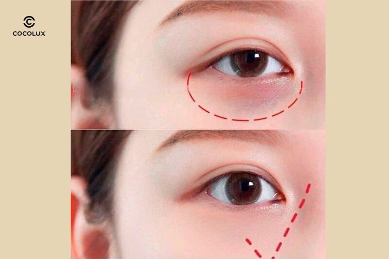 Kem Dưỡng Mắt Kumargic Eye Giảm Thâm Nhật Bản có khả năng làm giảm quầng thâm mắt nhanh chóng