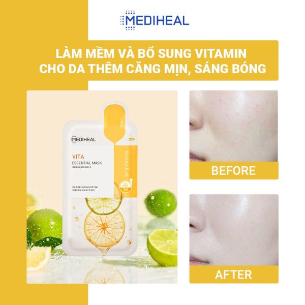 Mặt Nạ Mediheal Dưỡng Sáng, Mờ Thâm Cho Da Mụn 24ml