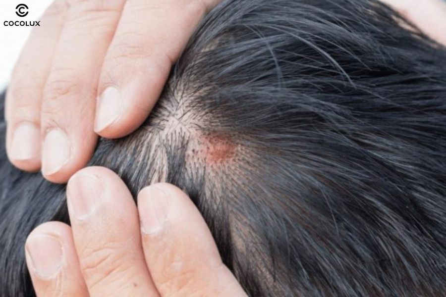 Màu tóc nam không cần tẩy giúp hạn chế tối đa hư tổn và kích ứng da đầu, tránh tình trạng khô xơ, gãy rụng hay bỏng rát do hóa chất mạnh gây ra