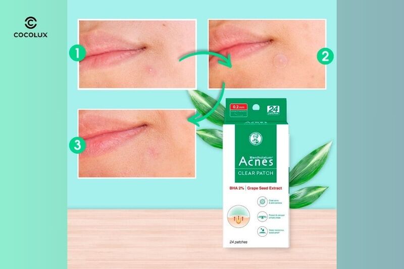 Miếng Dán Mụn Acnes có khả năng loại bỏ mụn nhanh chóng