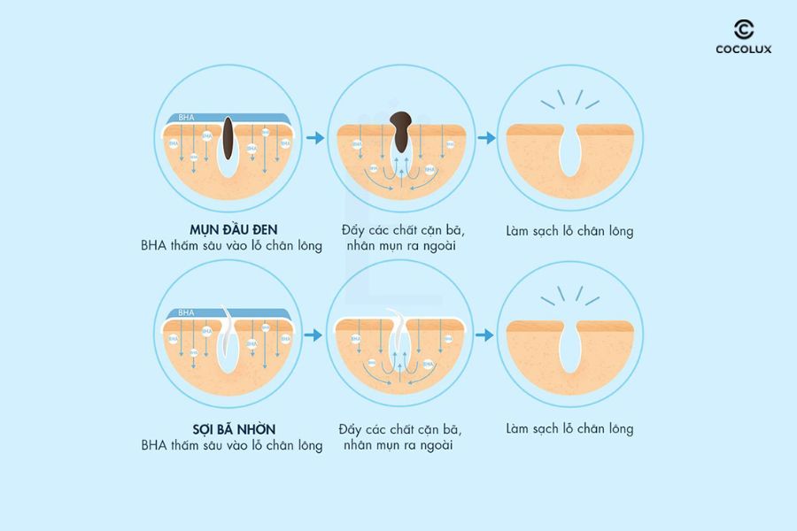 BHA loại bỏ tế b&agrave;o chết cải thiện t&igrave;nh trạng l&agrave;n da