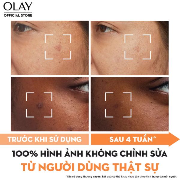 Kem Dưỡng Ẩm Trắng Da Olay Niacinamide & Vitamin C 50g