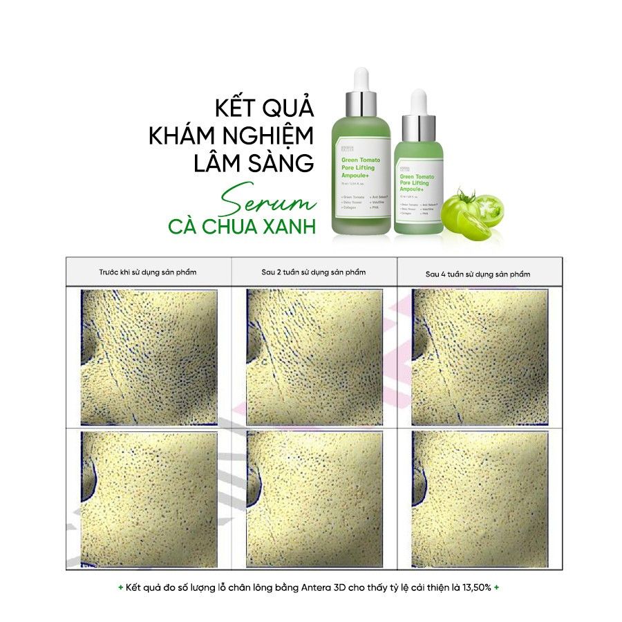 Serum Sungboon Green Tomato Pore Lifting Ampoule+ 40ml