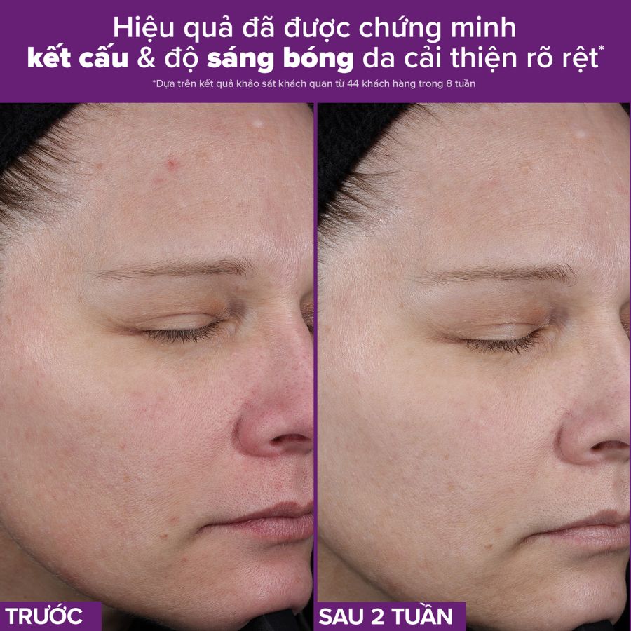 Tinh Chất Paula's Choice Retinaldehyde Ngăn Ngừa Lão Hóa và Hỗ Trợ Giảm Mụn 30ml