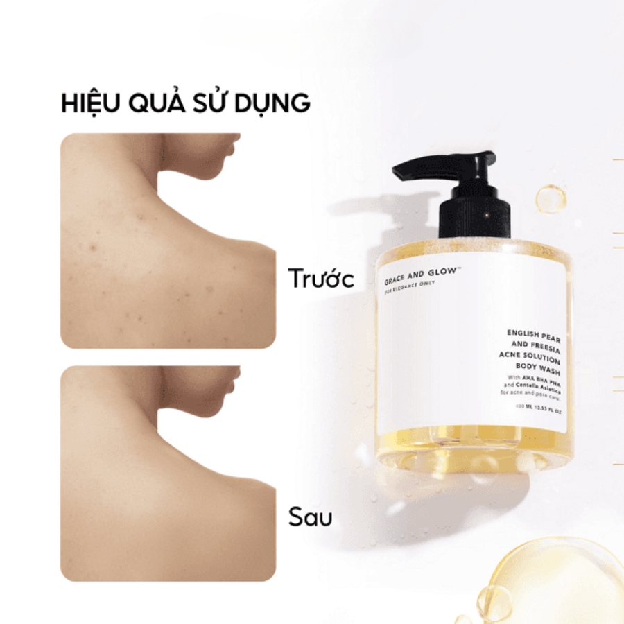 Sữa Tắm Giảm Mụn Grace And Glow English Pear And Freesia Anti Acne Solution 400ml