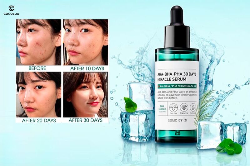 Tinh Chất Some By Mi AHA-BHA-PHA 30 Days Miracle Serum c&oacute; khả năng l&agrave;m giảm mụn sau 30 ng&agrave;y sử dụng