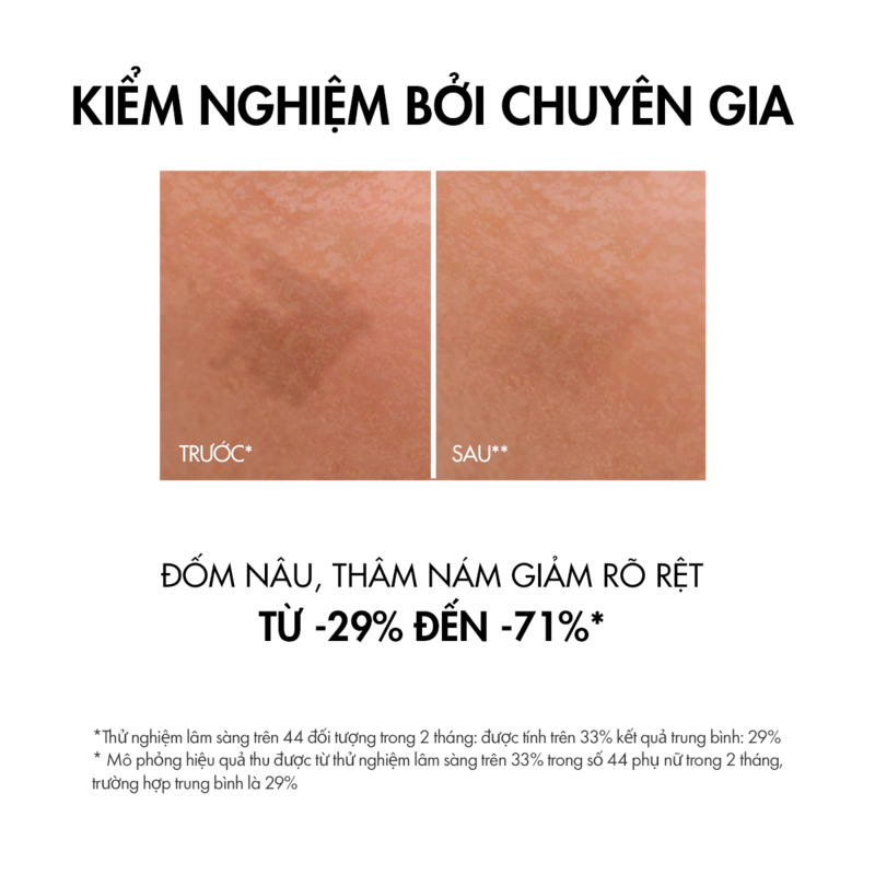 Tinh Chất Vichy Liftactiv B3 Serum Dark Spots & Wrinkles Làm Mờ Vết Thâm Và Nếp Nhăn 30ml