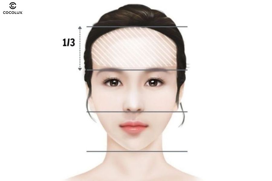 Trán cao là khi phần trán chiếm khoảng 1/3 chiều dài khuôn mặt