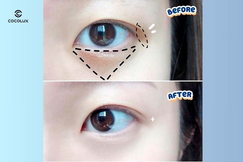 Kem Dưỡng Meishoku Whitening Eye Cream Giảm Thâm, Nhăn Mắt có khả năng làm giảm quầng thâm mắt nhanh chóng