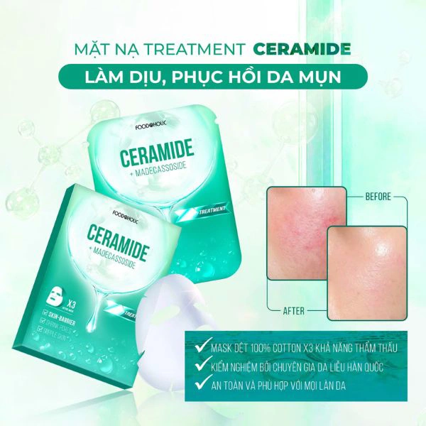 /upload/product/mat-na/mat-na-food-a-holic-ceramide-lam-diu-phuc-hoi-da-mun-1-pcs-3.webp